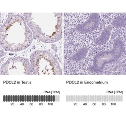 PDCL2 Antibody, Novus Biologicals:Antibodies:Primary Antibodies